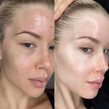 Radiant, smoother skin