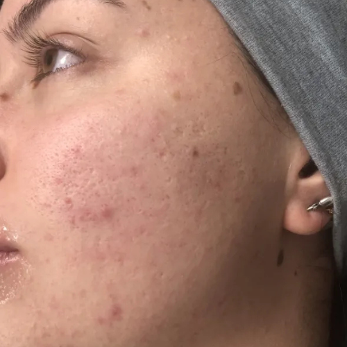 Day 1